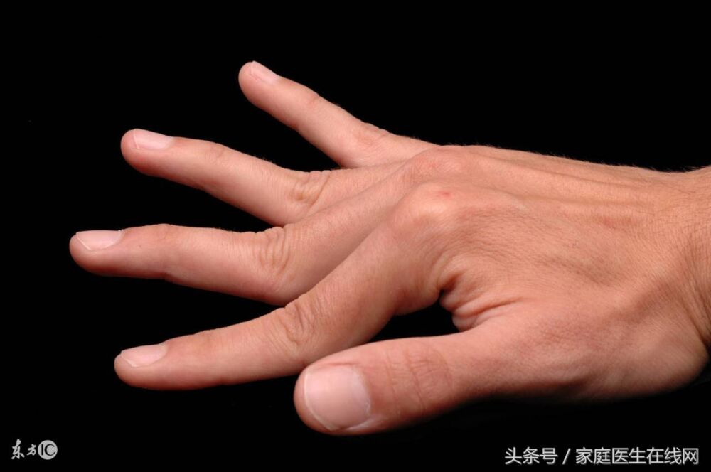 手指关节有刺痛（手指关节痛是什么原因）